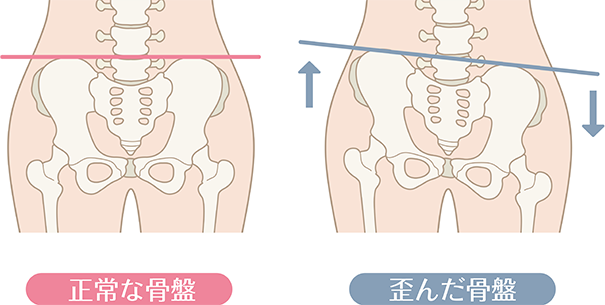 骨盤はプロポーションの要です